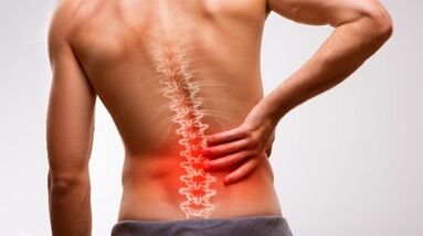 Unzeeche a Symptomer vun Osteochondrosis vun der Lendegpigelen