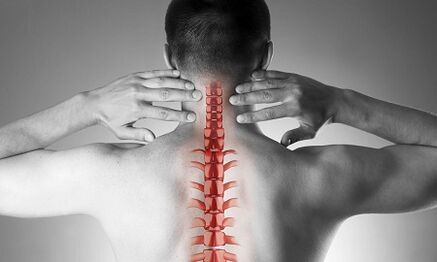 Wéi manifestéiert d'Osteochondrose vun der Gebärmutterhëllef
